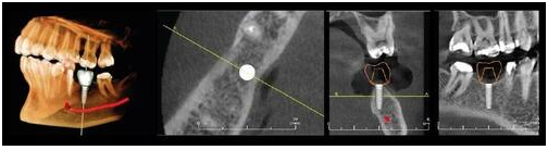 Reviewing the Various KaVo CBCT Imaging Options - Renew Digital, LLC